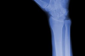 输卵管造影视频过程：医学影像的艺术与科学